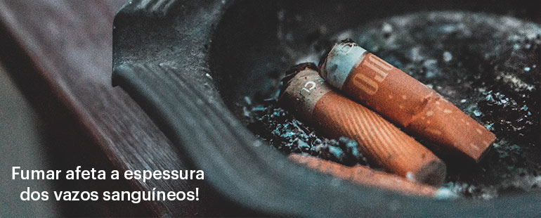 Cigarro afeta as varizes